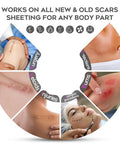 Advanced Scar Cream, 1.7 Oz(50Ml) Large Capacity, Silicone Scar Gel For After Surgical, C-Section, Stretch Marks, Keloids, Burns, Effective On Old & Scars,Lavender Scent