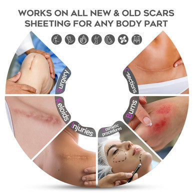 Advanced Scar Cream, 1.7 Oz(50Ml) Large Capacity, Silicone Scar Gel For After Surgical, C-Section, Stretch Marks, Keloids, Burns, Effective On Old & Scars,Lavender Scent