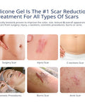 100% Silicone Scar Gel Scar Cream - Advanced Scar Gel For Surgical Scars, C-Section, Stretch Marks, Acne, Injury, Burns, Keloids, Old And Scars 1.06Oz(30G) (Maximum Strength 100% Silicone)