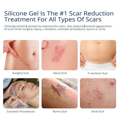 100% Silicone Scar Gel Scar Cream - Advanced Scar Gel For Surgical Scars, C-Section, Stretch Marks, Acne, Injury, Burns, Keloids, Old And Scars 1.06Oz(30G) (Maximum Strength 100% Silicone)