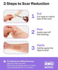 Awd Silicone Scar Sheets For Surgical Scars - Medical Grade Silicone Scar Tape For C Section, Tummy Tuck Tape, Keloid Treatment - Silicone Skin Patches After Surgery Must Haves (1.6" X 120" Roll)