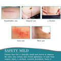 Silicone Scar Sheets - (1.6 X 60 ) Professional Scar Removal Sheets For C-Section, Burn, Acne - Soft Silicone Gel Scar Tape