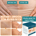 Silicone Scar Sheets (1.6" X 120"- 3 Meter), Medical Grade Silicone Scar Tape, Scar Removal Strips For Acne, Burn Scars C-Section & Keloid Surgery Scars Sheets Treatment Sheets