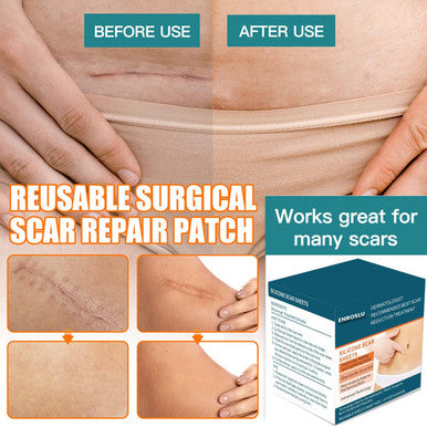 Silicone Scar Sheets (1.6" X 120"- 3 Meter), Medical Grade Silicone Scar Tape, Scar Removal Strips For Acne, Burn Scars C-Section & Keloid Surgery Scars Sheets Treatment Sheets