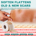 Silicone Scar Sheets, Silicone Scar Tape(1.6"X 158"), Scar Tape For Scar Removal Treatment, Reusable Silicone Scar Strips For Surgical, C-Section, Keloid, Burn, Acne, Surgical Scars
