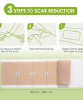 Auslka Silicone Scar Sheets(1.6"X 120" Roll-3M), Silicone Scar Tape, Scar Strips, Professional Silicone Scar Tape For C-Section, Tummy Tuck, Keloid, And Scar Patch