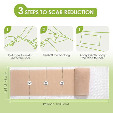 Auslka Silicone Scar Sheets(1.6"X 120" Roll-3M), Silicone Scar Tape, Scar Strips, Professional Silicone Scar Tape For C-Section, Tummy Tuck, Keloid, And Scar Patch