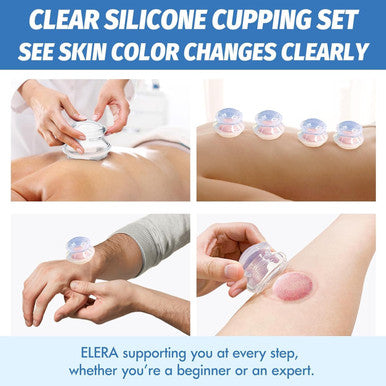 Elera Silicone Cupping Therapy Set, Professionally Chinese Massage Cups For Cupping Therapy And Cellulite Reduction (7 Cups)