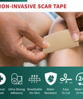 Medical Grade Silicone Scar Tape Advanced Adhesive Formulation (1.6" X 118") Scar Removal Away Strips For Surgical Scars, Silicone Tape & Keloid Scar Treatment, Reusable Silicone Scar Sheets