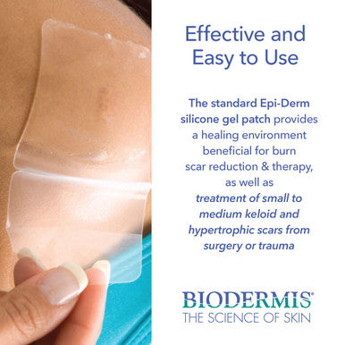 Epi-Derm Tnt Silicone Scar Patches, Effective For Old & Scars, Easily Cut To Size Patches, Thinner & More Comfortable, Premium Grade Silicone Scar Tape, 2 X 2.5 In - 5 Pairs, Clear