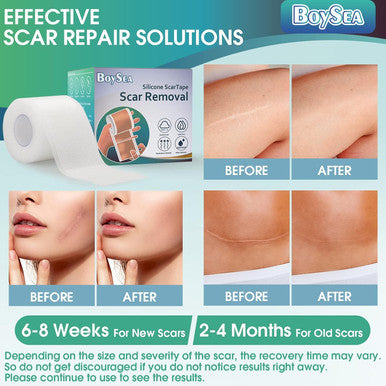Silicone Scar Sheets (1.6" X 120") Transparent Scar Tape - Scars Removal Treatment - Reusable Scar Strips For Keloid, C-Section, Burn, Surgical Scars