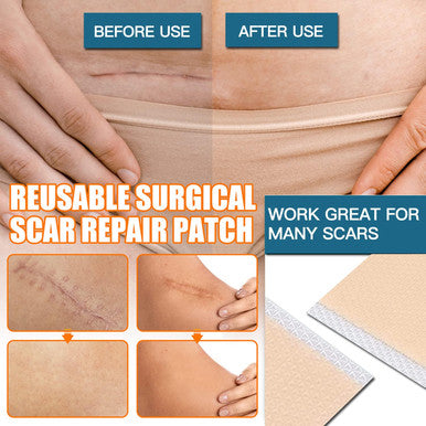 Silicone Scar Sheets (2 Rolls), Medical Grade Silicone Scar Tape, Scar Removal Strips For Acne, Burn Scars C-Section & Keloid Surgery Scars Sheets Treatment Sheets - 8 Month Supply