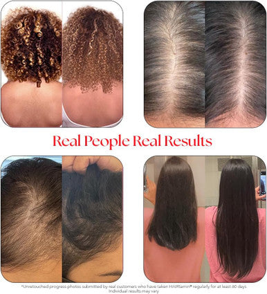 Hairtamin Advanced Hair & Scalp Serum Pack All-Natural Vegan Biotin Capsules & Serum Sample For Hair, Skin & Nail Growth