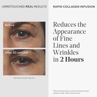 Murad Rapid Collagen Infusion Anti-Aging Serum With Collagen Amino Acids & Winged Kelp Extract For Visible Wrinkle Reduction Enhanced Skin Firmness & Re-Volumizes Skin 1.0 Fl Oz