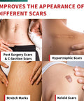 Medical Grade Silicone Scar Tape Advanced Adhesive Formulation (1.6" X 118") Scar Removal Away Strips For Surgical Scars, Silicone Tape & Keloid Scar Treatment, Reusable Silicone Scar Sheets