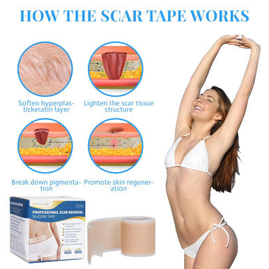 Silicone Scar Sheets, Silicone Scar Tape Roll (60 X1.6 ), Professional Scars Removal Treatment, Scar Silicone Strips, Reusable Silicone Scar Strips Type For Keloid, C-Section, Surgery, Keloid, Acne