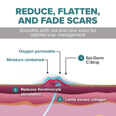 Epiderm Silicone Gel Scar Strips - Premium-Grade Silicone Scar Tape For Optimal Scar Care-Versatile, Flexible & Reusable - Ideal For C-Section, Tummy Tuck & Cardiac Surgery Scars - 1.4"X6", Clear