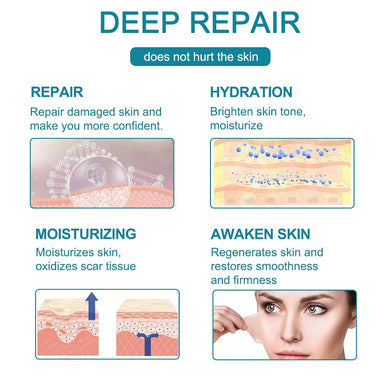 Silicone Scar Sheets - (1.6 X 60 ) Professional Scar Removal Sheets For C-Section, Burn, Acne - Soft Silicone Gel Scar Tape