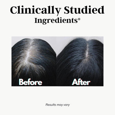 DR VITAMIN SOLUTIONS Gray Hair Rescind With Catalase Antiaging Hair Skin And Nails Vitamins Pantothenic Acid Folic Acid 400Mcg Biotin 300Mcg Saw Palmetto For Men And Women 60 Capsules