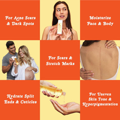 Bio-Oil Skincare Oil Serum For Scars And Stretchmarks Face Body Moisturizer Dry Skin With Organic Jojoba Oil Vitamin E Natural Rosehip For All Skin Types 4.2 Oz