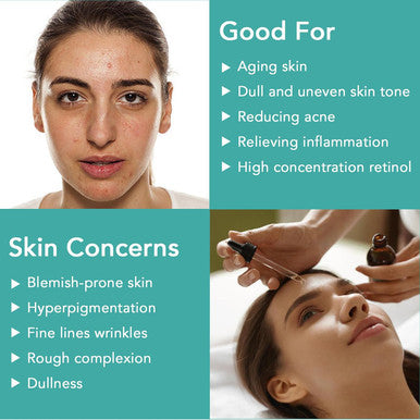 Elbbub Retinol Serum - Retinol Liposome Delivery System with Hyaluronic Acid and Vitamin E Aloe Anti Aging Retinol Serum for Skin Repair Fine Line and Wrinkles