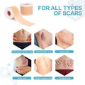 Silicone Scar Sheets (1.6 X120 Roll-3M), 1 Roll Medical Grade Washable Silicone Scar Tape, Reusable Scar Removal Sheets For C-Section, Surgery, Burn, Keloid, Acne