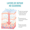 Scar Gel Advanced Scar Treatment, Silicone Scar Gel Scar Removal Scar Cream Gel Silicone Gel Scar Gel For Face C-Section Tummy Tuck Keloid And Surgical Scars Burns Old Scars Deep Acne Scar Removal