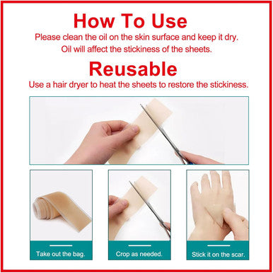 Silicone Scar Sheets (1.6 X 120 Roll-3M), Silicone Scar Tape Roll, Scar Silicone Strips, Reusable, Professional Scar Removal Sheets For C-Section, Surgery, Burn, Keloid, Acne Et