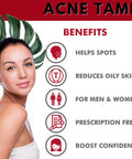Acne Pills- Acne Tame Supplement- Clear Skin Vitamins Pill For Oily Skin Treatment, Hormonal Blemishes, Anti Spots & Cystic Acnes Supplements For Women, Men, Teens & Adults- 60 Oral Tablets