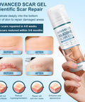 Advanced Scar Cream, Silicone Scar Gel, Treats Old And Scars, Reduces The Appearance Of Scars From, Body, Face, Stretch Marks, Surgical Scar, Keloids, Acne, Burns And More, 1.7 Oz