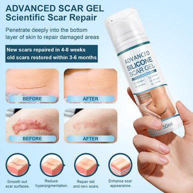Advanced Scar Cream, Silicone Scar Gel, Treats Old And Scars, Reduces The Appearance Of Scars From, Body, Face, Stretch Marks, Surgical Scar, Keloids, Acne, Burns And More, 1.7 Oz