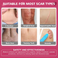 Silicone Scar Sheets,Silicone Scar Tape,Scar Tape For Surgical Scars,C-Section,Tummy Tuck,Keloid Bump Removal (1.6"X 59" Roll-1.5M-Pigment Reduction Enhanced Version-Pink)