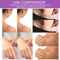 Silicone Scar Tape For Scar Treatment, Advanced Scar Removal Sheets, Soften And Flattens Old Scars And Scars Which Resulting From Surgery, Acne, Injury, Burns, C-Section And More (1.6 X 60 )
