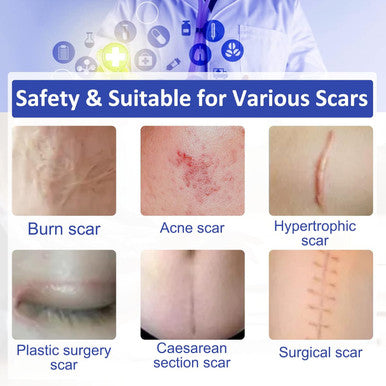 Silicone Scar Sheets (1.6 X 120 ), Clear Gel Silicone Scar Tape, Invisible Medical Grade Scar Silicone Strips, Transparent Advanced Removal Scar Patches For C-Section, Keloids, Burn, Acne