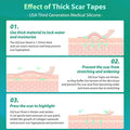 Silicone Scar Sheets, Medical Grade Silicone Scar Tape, Scar Removal Strips For Acne Scars C-Section & Keloid Surgery Scars Sheets Treatment Sheets -1.6"X 60" Roll-1.5M