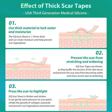 Silicone Scar Sheets, Medical Grade Silicone Scar Tape, Scar Removal Strips For Acne Scars C-Section & Keloid Surgery Scars Sheets Treatment Sheets -1.6"X 60" Roll-1.5M