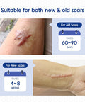 Murasaki Beauty Silicone Scar Tape & Sheets Removal On Keloids, Burns, Abrasion, C-Section, And Surgical Scars Safe For Adults And Children 1.6"X 60" Roll-4 X 1.5M(Pack Of 1) (1.6X60Inch)