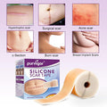 Silicone Scar Tape For Scar Treatment, Advanced Scar Removal Sheets, Soften And Flattens Old Scars And Scars Which Resulting From Surgery, Acne, Injury, Burns, C-Section And More (1.6 X 60 )