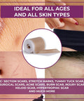 Medical Grade Silicone Scar Sheets - Non-Irritating Scar Strips For Surgical Scars, C-Section, Tummy Tuck, And Keloid - Premium Soft Gel Strips For Pain-Scar Removal (1.6In X 120In)
