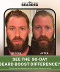 Live Bearded: Beard Boost - Beard Hair Growth Multivitamins With Biotin 10,000Mcg, Vitamin C, Vitamin E And Zinc - 30-Day Supply - Thick, Strong, Full Beard Growth Support - Made In The Usa