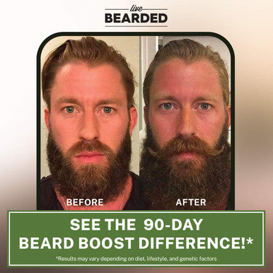 Live Bearded: Beard Boost - Beard Hair Growth Multivitamins With Biotin 10,000Mcg, Vitamin C, Vitamin E And Zinc - 30-Day Supply - Thick, Strong, Full Beard Growth Support - Made In The Usa