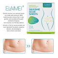 Medical Grade Silicone Scar Sheets, Silicone Scar Tape (1.6 X 60 ), Scar Removal Strips For Acne Scars C-Section & Keloid Surgery Scars Sheets Treatment Sheets - 6-8 Month Supply