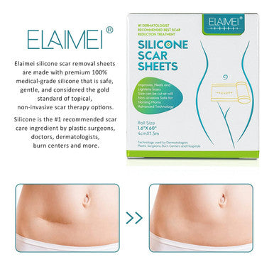 Medical Grade Silicone Scar Sheets, Silicone Scar Tape (1.6 X 60 ), Scar Removal Strips For Acne Scars C-Section & Keloid Surgery Scars Sheets Treatment Sheets - 6-8 Month Supply