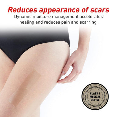 Neo G Opti-Heal Wound Recovery Silicone Scar Strips For Surgical Scars, C Section, Burn, Acne, Keloid Treatment - Medical Silicone Scar Sheets - And Old Scar Treatment - 1.6 X 5.9 Inch - 6 Strips