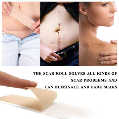 Medical Grade Silicone Scar Sheets, Silicone Scar Tape (1.6 X 60 ), Scar Removal Strips For Acne Scars C-Section & Keloid Surgery Scars Sheets Treatment Sheets - 6-8 Month Supply