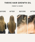 Forest & Shore Hair Growth Oil 100% Natural Hair Oil with Caffeine Biotin Castor Oil Argan Oil Coconut Oil and Rosemary Oil Effective Thickening Mask & Hair Loss Treatment