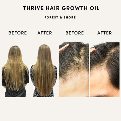 Forest & Shore Hair Growth Oil 100% Natural Hair Oil with Caffeine Biotin Castor Oil Argan Oil Coconut Oil and Rosemary Oil Effective Thickening Mask & Hair Loss Treatment