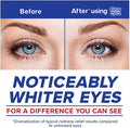 Clear Eyes Maximum Redness Relief Eye Drops | Relieves Drying, Burning & Irritations | 0.5 Ounce per Box | 6 Boxes Total