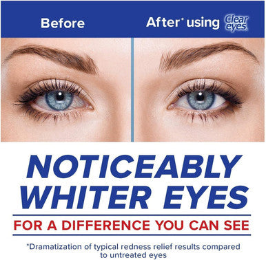 Clear Eyes Maximum Redness Relief Eye Drops | Relieves Drying, Burning & Irritations | 0.5 Ounce per Box | 6 Boxes Total