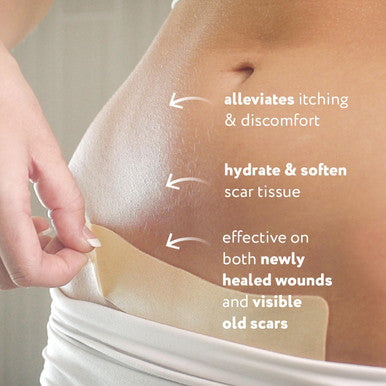Scaraway Advanced Silicone Scar Sheets For C-Section, Reusable Sheets (1.5 X 7 ) For Hypertrophic And Keloid Scars From C-Section & Other Surgeries, 4 Sheets